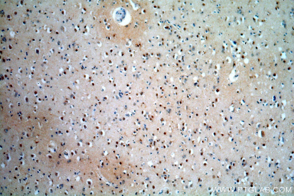 Immunohistochemistry (IHC) staining of human brain tissue using RUFY2 Polyclonal antibody (19180-1-AP)