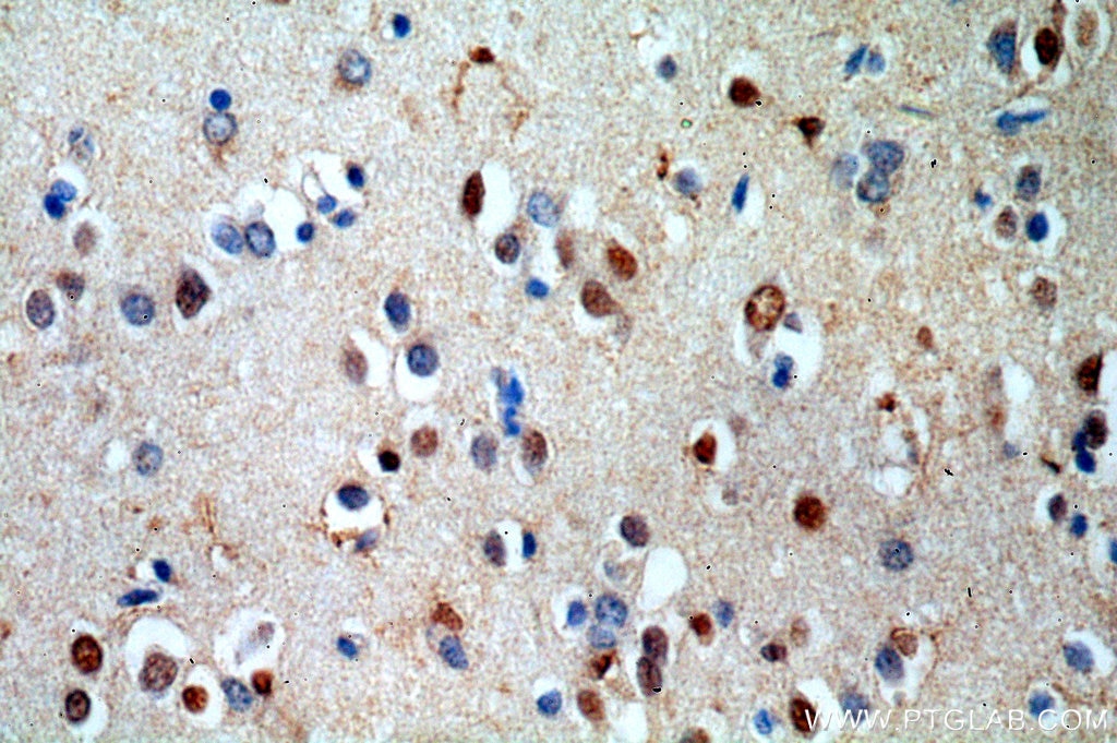 Immunohistochemistry (IHC) staining of human brain tissue using RUFY2 Polyclonal antibody (19180-1-AP)