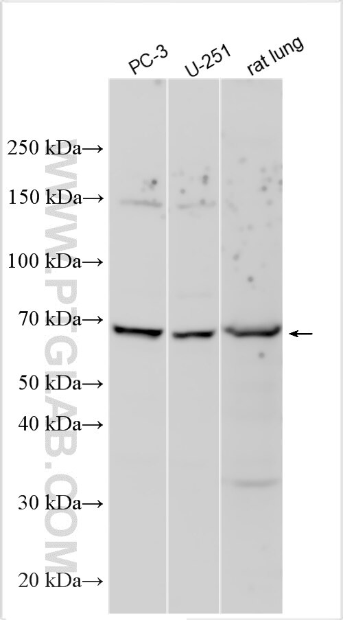 Western Blot (WB) analysis of various lysates using RUFY2 Polyclonal antibody (19180-1-AP)