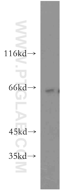 Western Blot (WB) analysis of PC-3 cells using RUFY2 Polyclonal antibody (19180-1-AP)