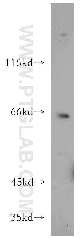 Western Blot (WB) analysis of PC-3 cells using RUFY2 Polyclonal antibody (19180-1-AP)
