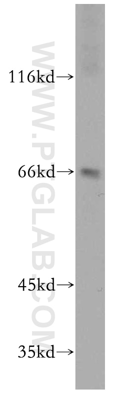 Western Blot (WB) analysis of mouse lung tissue using RUFY2 Polyclonal antibody (19180-1-AP)
