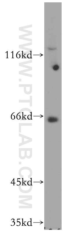 Western Blot (WB) analysis of mouse ovary tissue using RUFY2 Polyclonal antibody (19180-1-AP)
