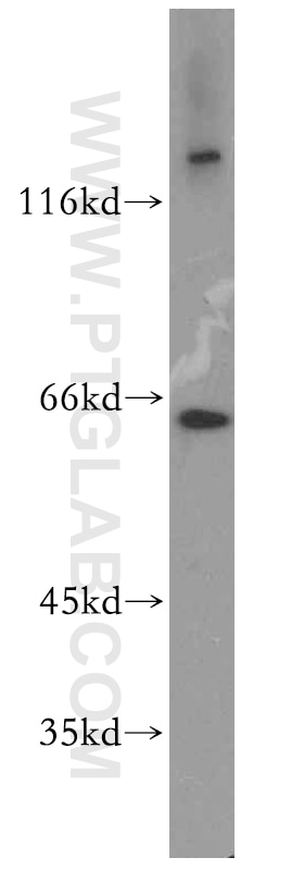 Western Blot (WB) analysis of SH-SY5Y cells using RUFY2 Polyclonal antibody (19180-1-AP)
