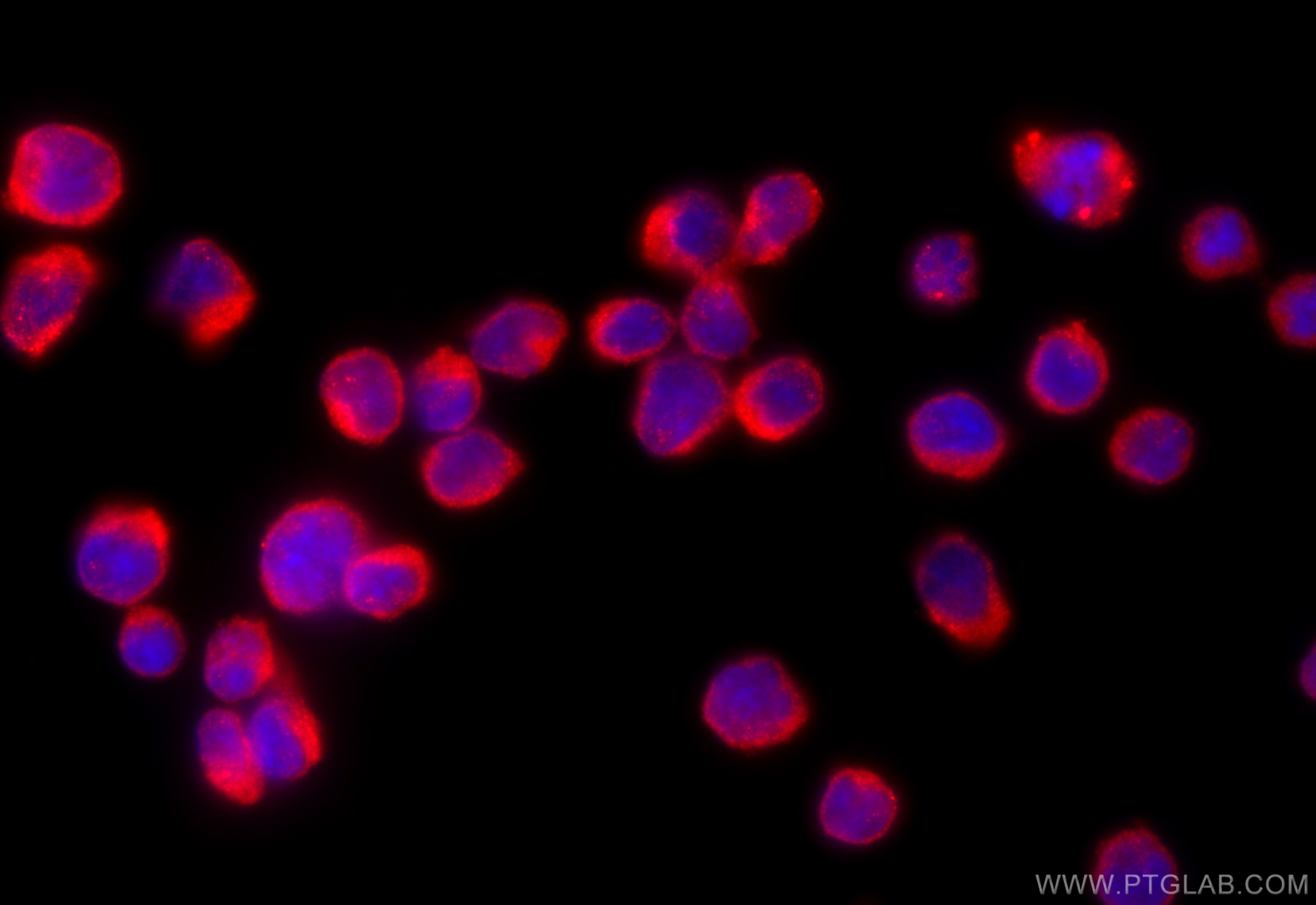 IF Staining of Jurkat using 15383-1-AP Immunofluorescence (IF) / fluorescent staining of Jurkat cells using RUFY3 Polyclonal antibody (15383-1-AP)