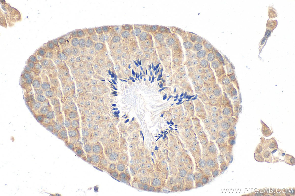 IHC staining of mouse testis using 15383-1-AP Immunohistochemistry (IHC) staining of mouse testis tissue using RUFY3 Polyclonal antibody (15383-1-AP)