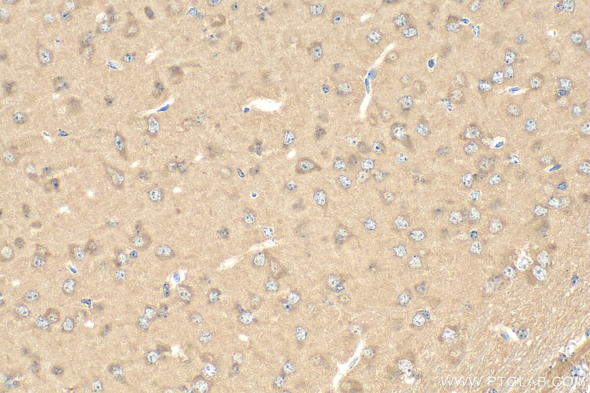 IHC staining of mouse brain using 15383-1-AP Immunohistochemistry (IHC) staining of mouse brain tissue using RUFY3 Polyclonal antibody (15383-1-AP)