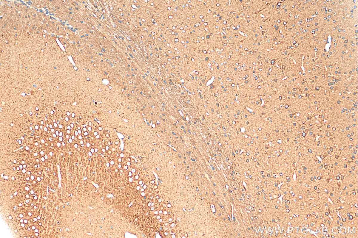 Immunohistochemistry (IHC) staining of mouse brain tissue using RUNDC3A Polyclonal antibody (20531-1-AP)