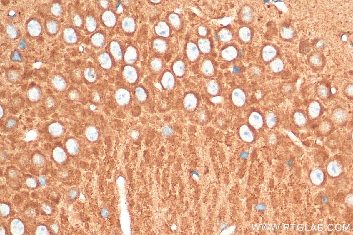 Immunohistochemistry (IHC) staining of mouse brain tissue using RUNDC3A Polyclonal antibody (20531-1-AP)