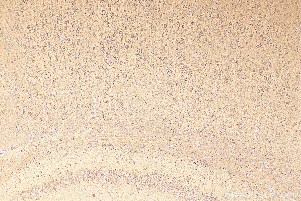 Immunohistochemistry (IHC) staining of mouse brain tissue using RUNDC3A Polyclonal antibody (20531-1-AP)
