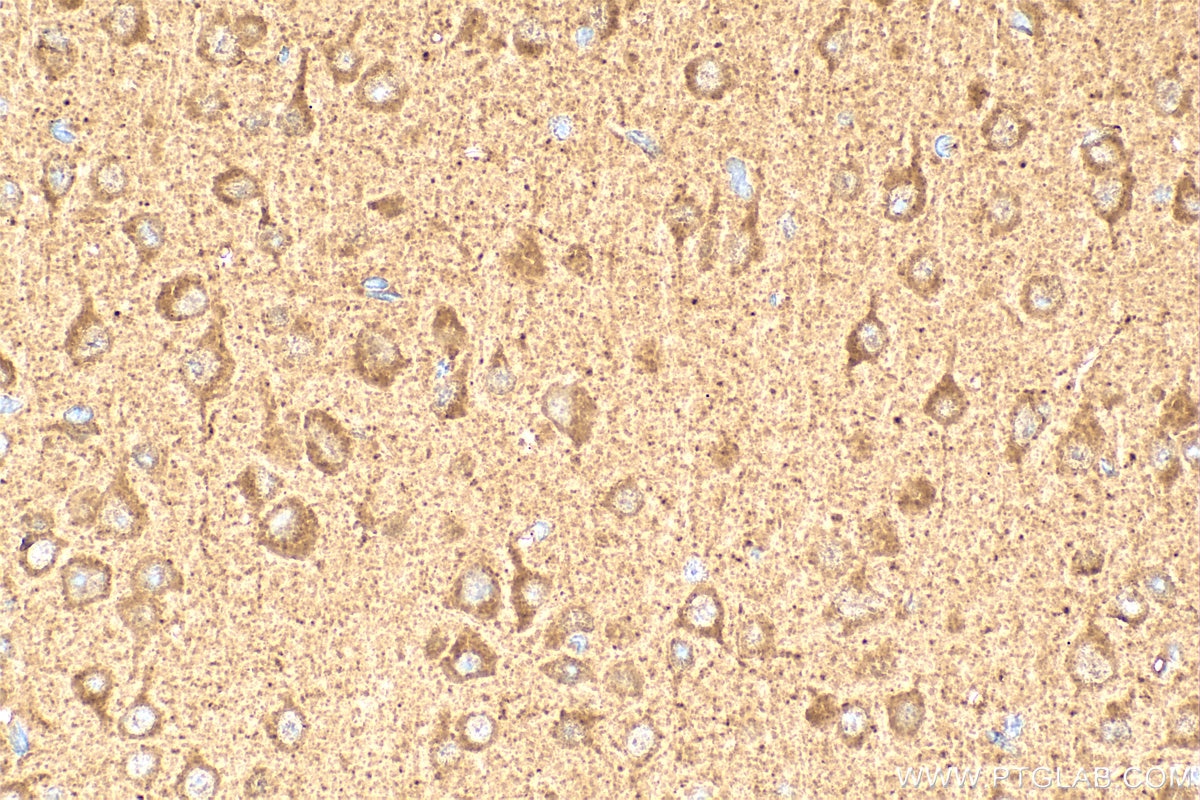 Immunohistochemistry (IHC) staining of mouse brain tissue using RUNDC3A Polyclonal antibody (20531-1-AP)