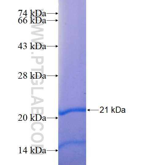 RUNDC3A fusion protein Ag15219 SDS-PAGE