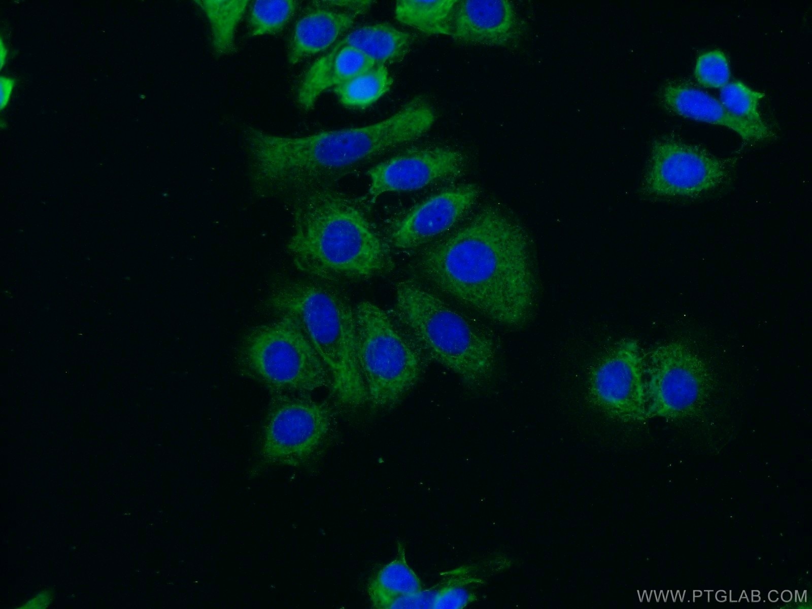 Immunofluorescence (IF) / fluorescent staining of MCF-7 cells using RUNDC3B Polyclonal antibody (17113-1-AP)