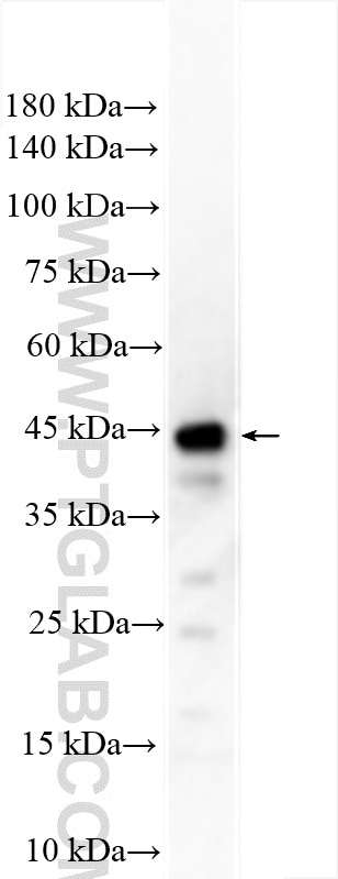 Western Blot (WB) analysis of mouse brain tissue using RUNDC3B Polyclonal antibody (17113-1-AP)