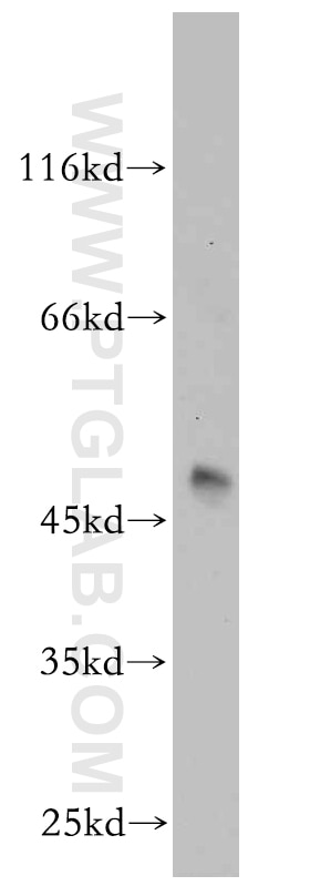 Western Blot (WB) analysis of mouse brain tissue using RUNDC3B Polyclonal antibody (17113-1-AP)