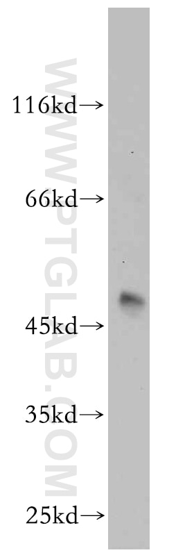 WB analysis of mouse brain using 17113-1-AP