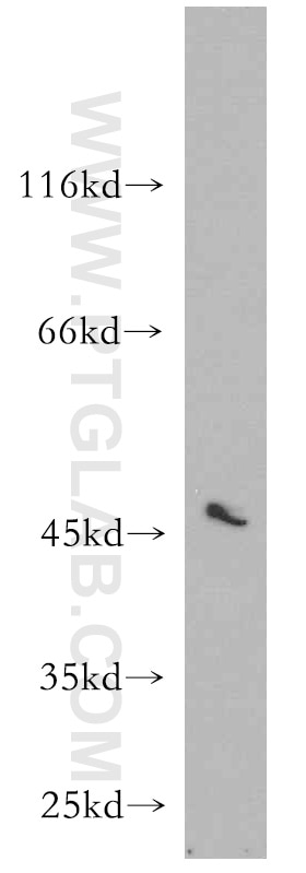 Western Blot (WB) analysis of MCF-7 cells using RUNDC3B Polyclonal antibody (17113-1-AP)