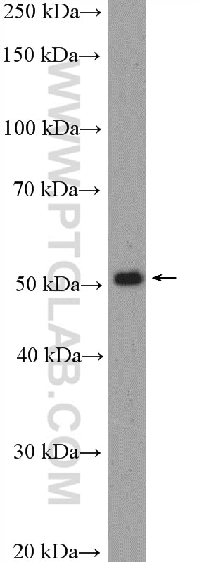 WB analysis of mouse liver using 19555-1-AP