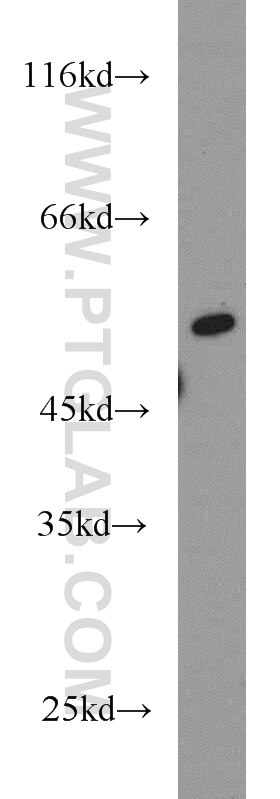 WB analysis of mouse thymus using 19555-1-AP