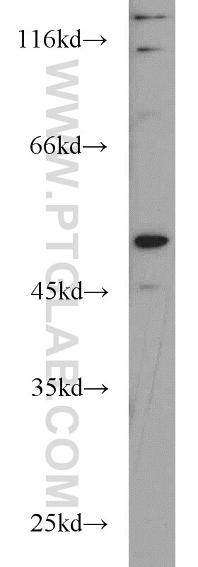 WB analysis of MCF-7 using 19555-1-AP