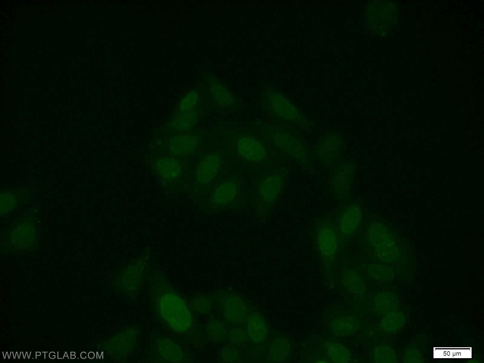 Immunofluorescence (IF) / fluorescent staining of HepG2 cells using RUNX1 (middle) Polyclonal antibody (25315-1-AP)