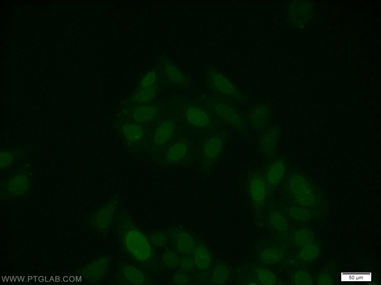 IF Staining of HepG2 using 25315-1-AP