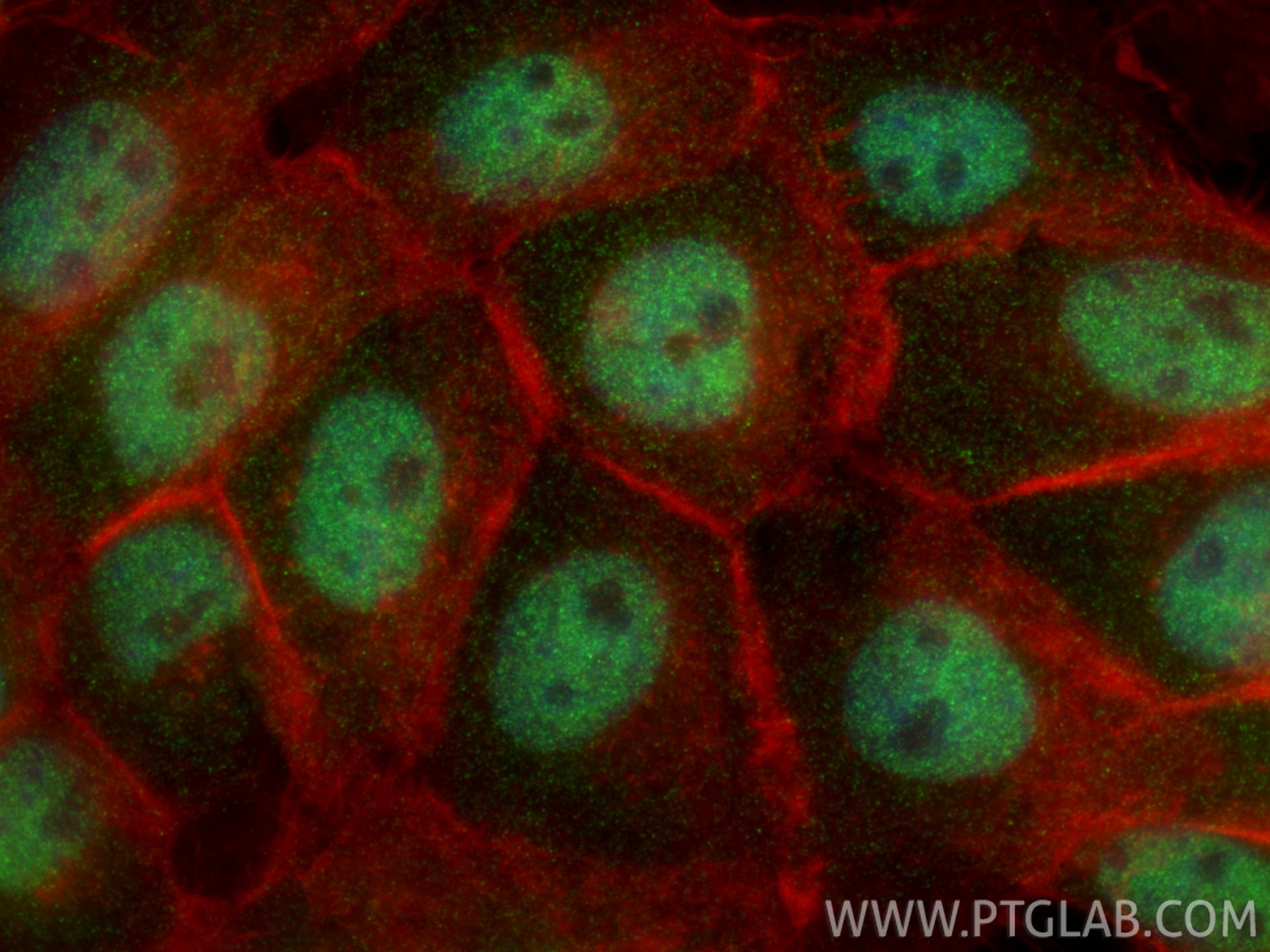 Immunofluorescence (IF) / fluorescent staining of U-251 cells using RUNX1 (middle) Polyclonal antibody (25315-1-AP)