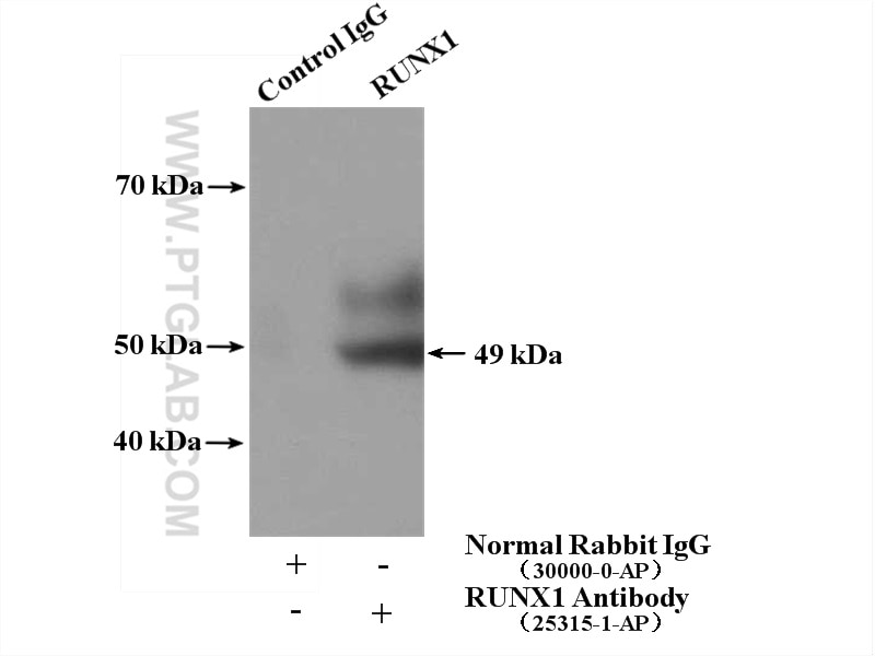 Immunoprecipitation (IP) experiment of Jurkat cells using RUNX1 (middle) Polyclonal antibody (25315-1-AP)