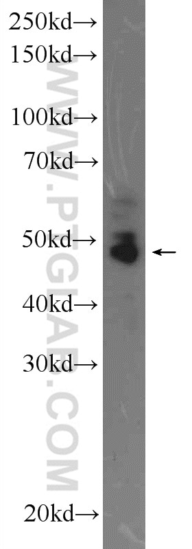 Western Blot (WB) analysis of Jurkat cells using RUNX1 (middle) Polyclonal antibody (25315-1-AP)