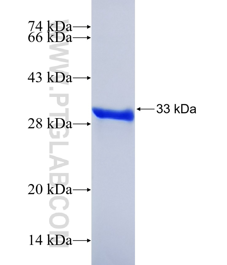 RUNX1 fusion protein Ag17838 SDS-PAGE