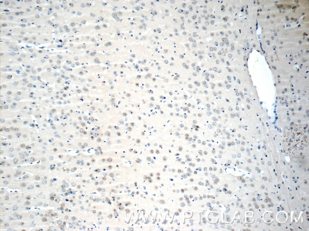Immunohistochemistry (IHC) staining of mouse brain tissue using RUNX1T1 Polyclonal antibody (15494-1-AP)