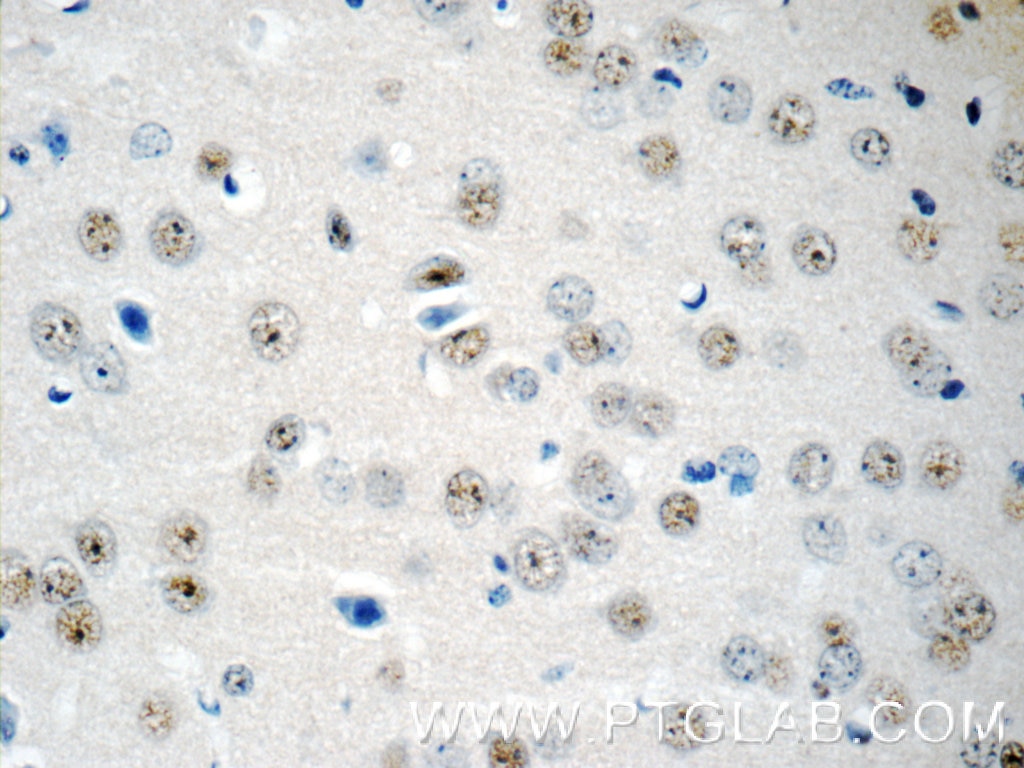 Immunohistochemistry (IHC) staining of mouse brain tissue using RUNX1T1 Polyclonal antibody (15494-1-AP)