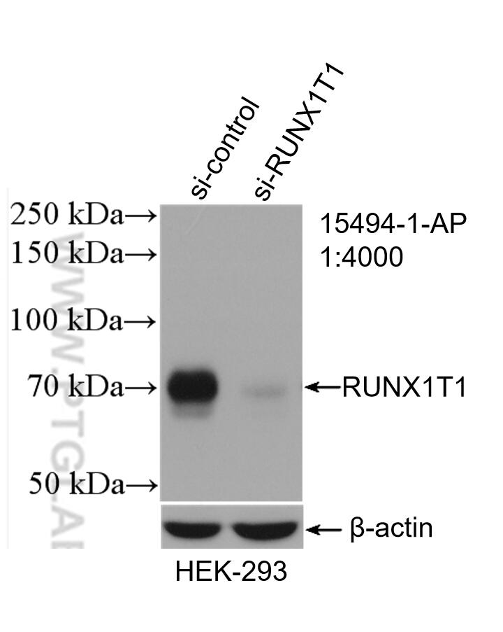 Western Blot (WB) analysis of HEK-293 cells using RUNX1T1 Polyclonal antibody (15494-1-AP)