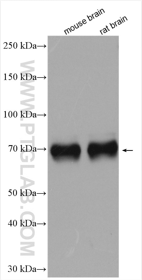 Western Blot (WB) analysis of various lysates using RUNX1T1 Polyclonal antibody (15494-1-AP)