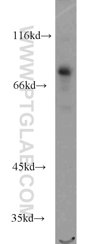 Western Blot (WB) analysis of Jurkat cells using RUNX1T1 Polyclonal antibody (15494-1-AP)