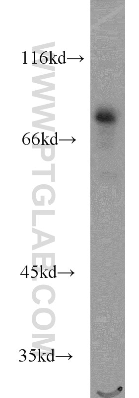 WB analysis of Jurkat using 15494-1-AP