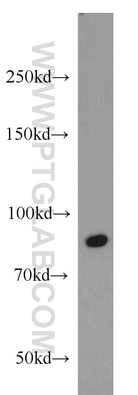 Western Blot (WB) analysis of HepG2 cells using RUNX1T1 Polyclonal antibody (15494-1-AP)