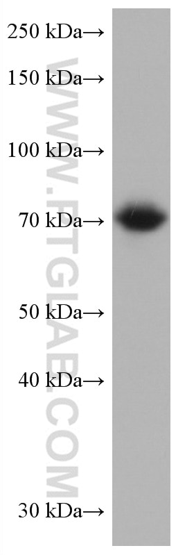 Western Blot (WB) analysis of HEK-293 cells using RUNX1T1 Monoclonal antibody (67086-1-Ig)