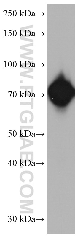 Western Blot (WB) analysis of Jurkat cells using RUNX1T1 Monoclonal antibody (67086-1-Ig)