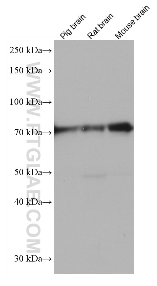 Western Blot (WB) analysis of various lysates using RUNX1T1 Monoclonal antibody (67086-1-Ig)