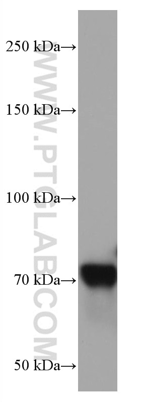 Western Blot (WB) analysis of Jurkat cells using RUNX1T1 Monoclonal antibody (67086-1-Ig)