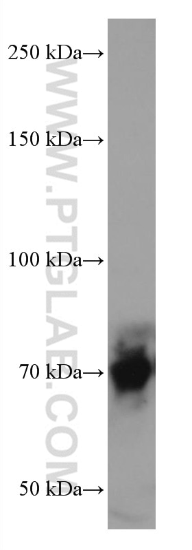 Western Blot (WB) analysis of rat brain tissue using RUNX1T1 Monoclonal antibody (67086-1-Ig)