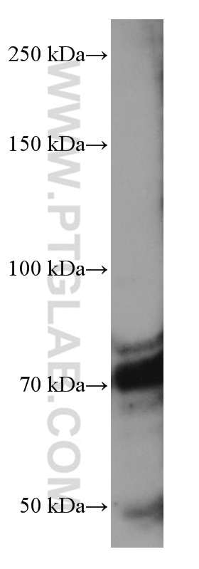 Western Blot (WB) analysis of mouse brain tissue using RUNX1T1 Monoclonal antibody (67086-1-Ig)