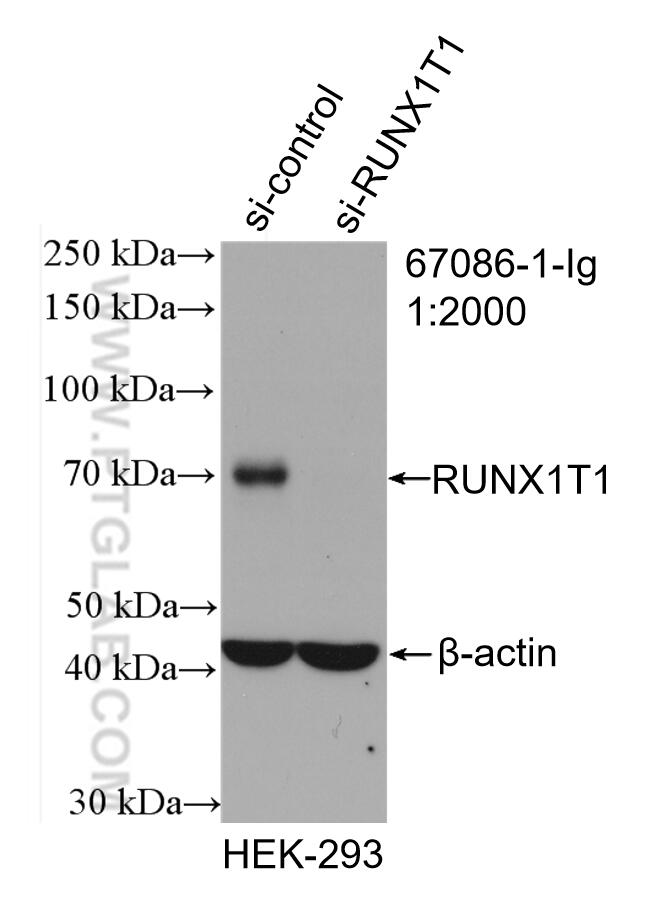 Western Blot (WB) analysis of HEK-293 cells using RUNX1T1 Monoclonal antibody (67086-1-Ig)