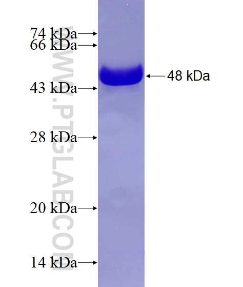 RUNX1T1 fusion protein Ag7893 SDS-PAGE