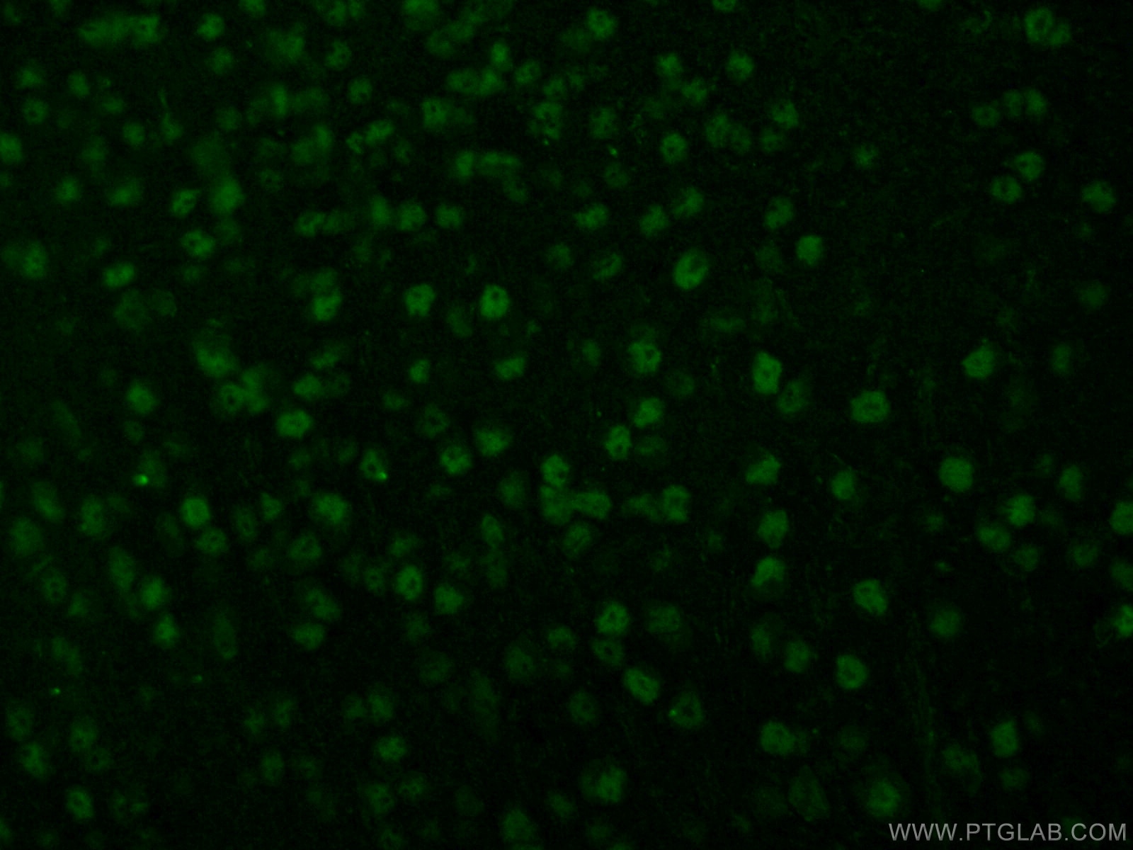 Immunofluorescence (IF) / fluorescent staining of mouse brain tissue using RUNX2 Polyclonal antibody (20700-1-AP)