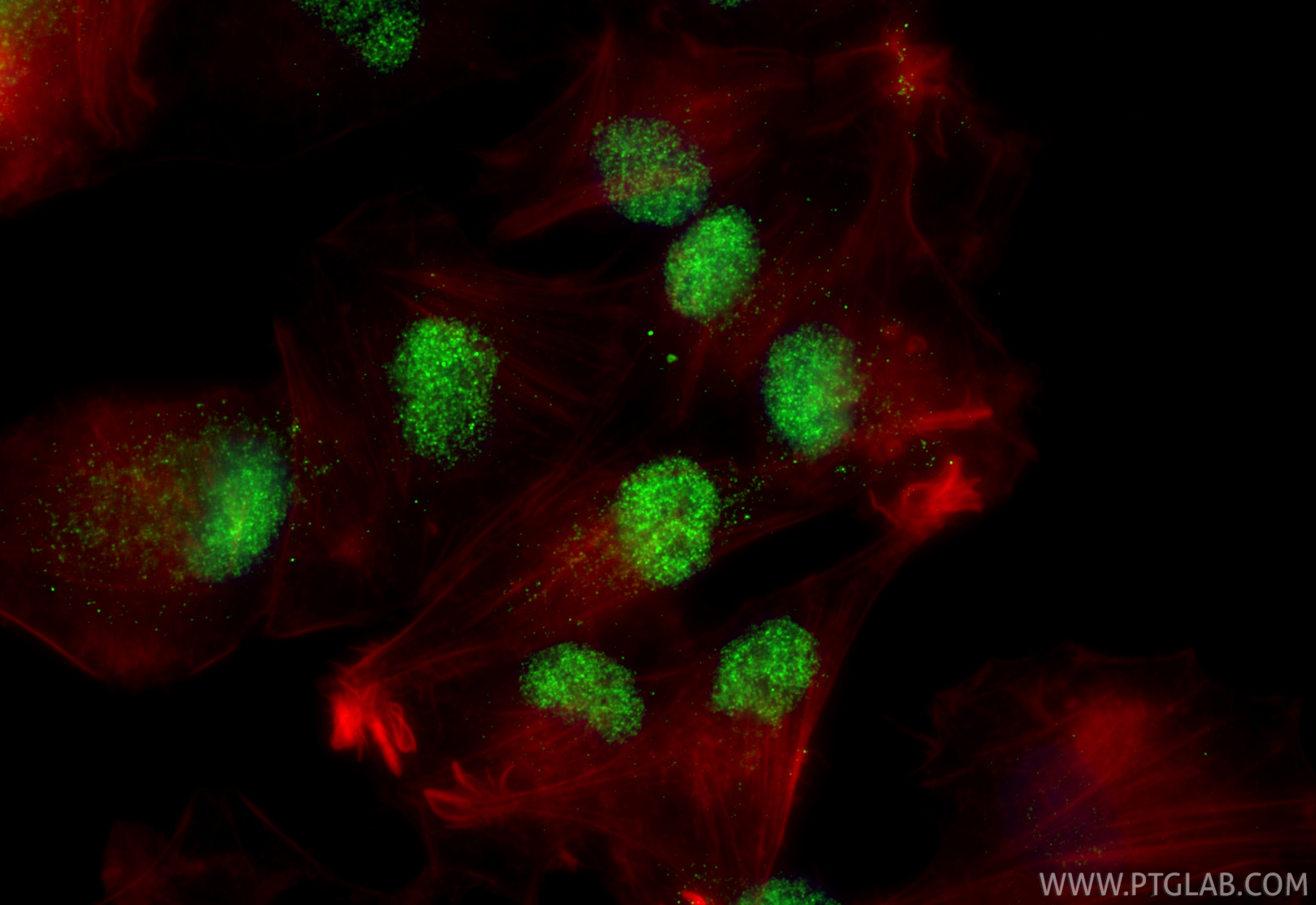 Immunofluorescence (IF) / fluorescent staining of ROS1728 cells using RUNX2 Polyclonal antibody (20700-1-AP)