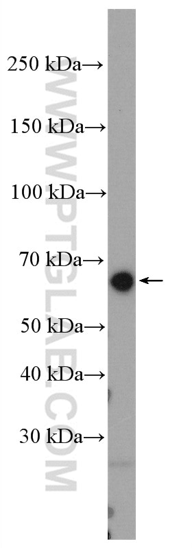 Western Blot (WB) analysis of ROS1728 cells using RUNX2 Polyclonal antibody (20700-1-AP)