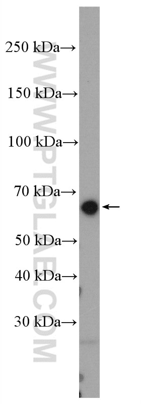 WB analysis of ROS1728 using 20700-1-AP
