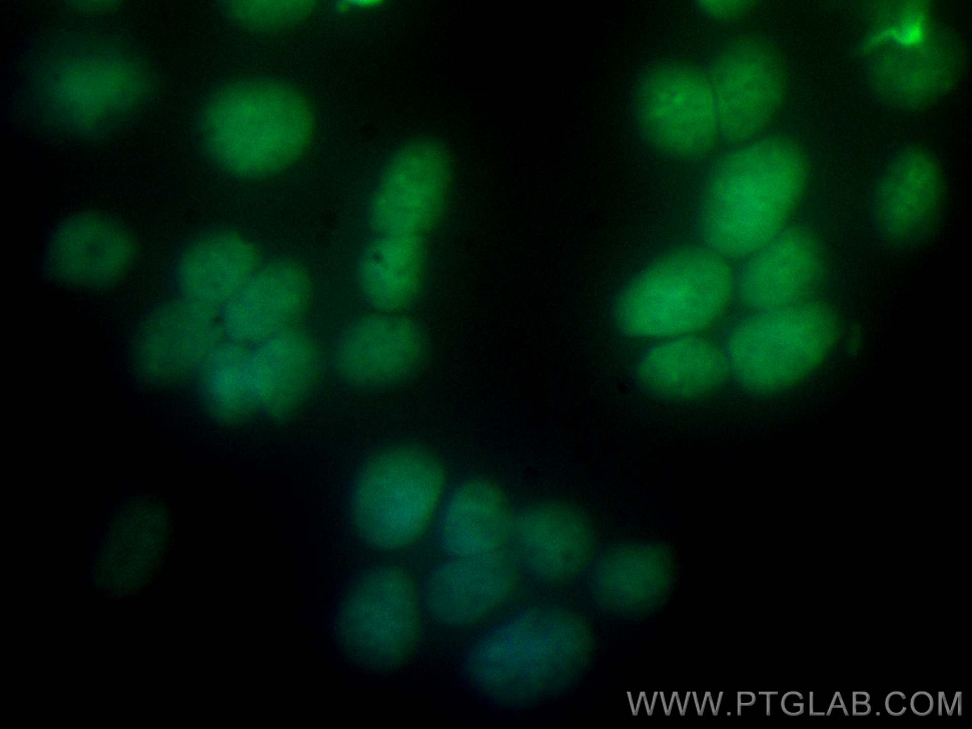 IF Staining of SH-SY5Y using CL488-20700